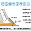 獣医コラム/肢蹄病の原因と予防(17)- 蹄の病気について